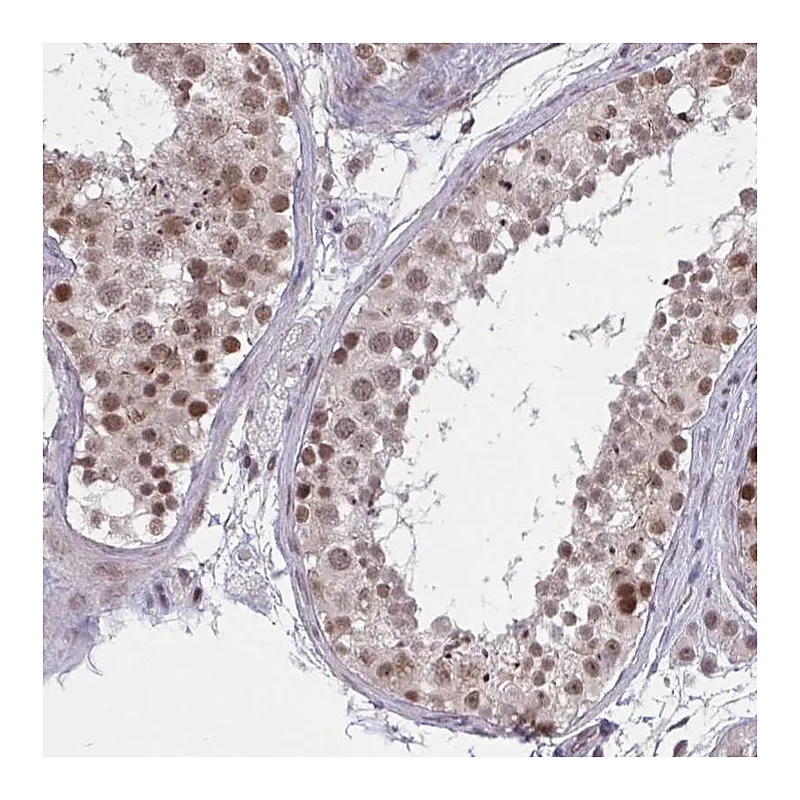 Atlas Antibodies Anti-ZNF414 Antibody