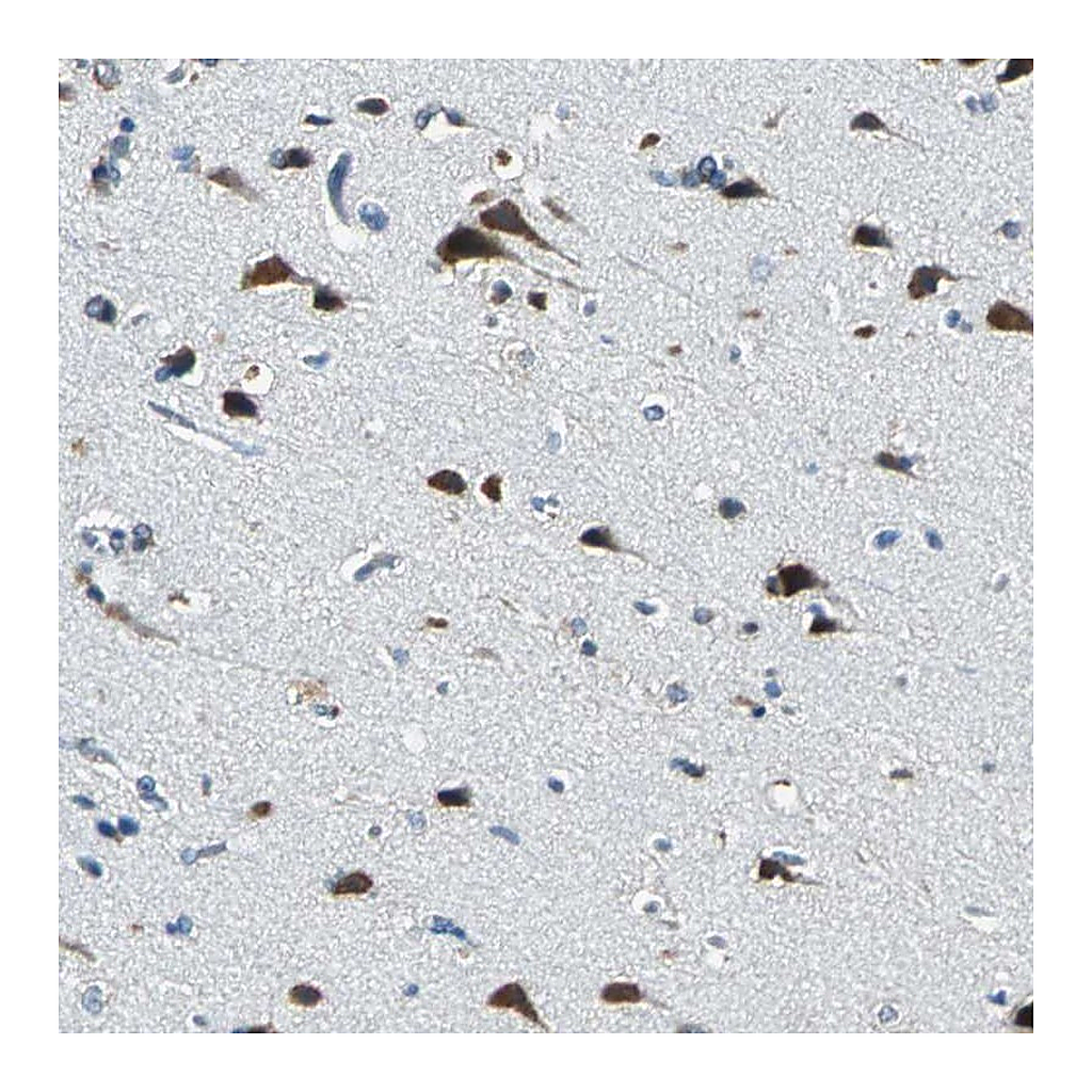 Atlas Antibodies Anti-ZNF415 Antibody