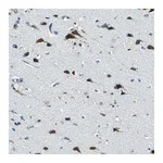 Atlas Antibodies Anti-ZNF415 Antibody