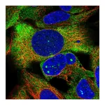 Atlas Antibodies Anti-ZNF416 Antibody