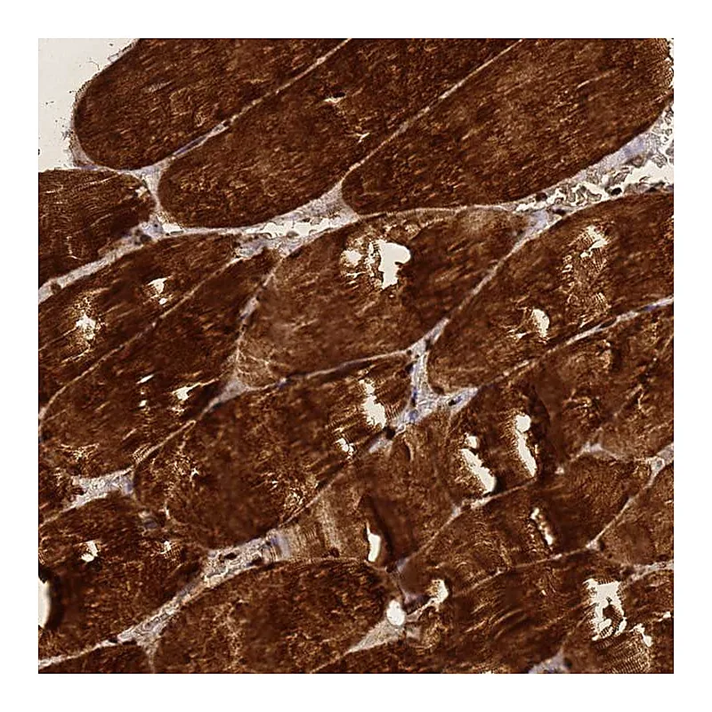 Atlas Antibodies Anti-ZNF417 Antibody