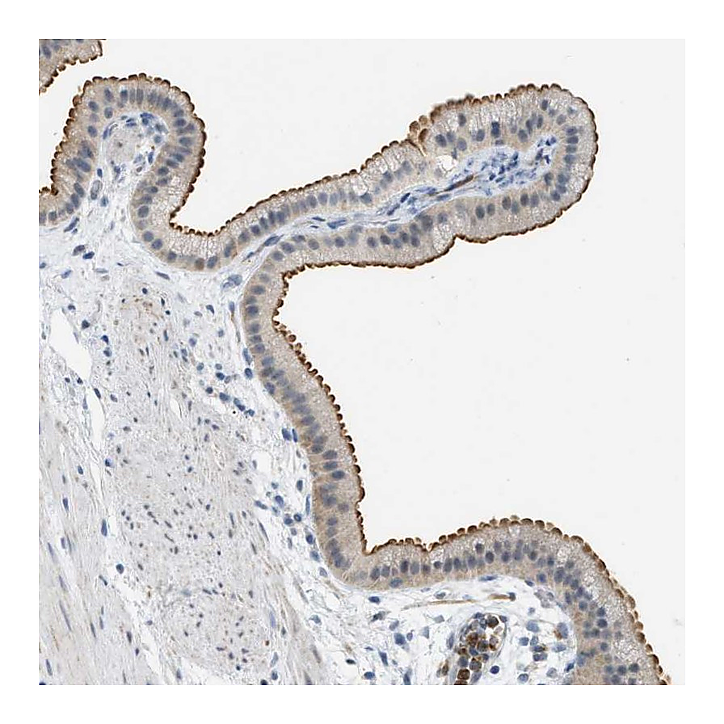 Atlas Antibodies Anti-ZNF408 Antibody