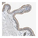 Atlas Antibodies Anti-ZNF408 Antibody