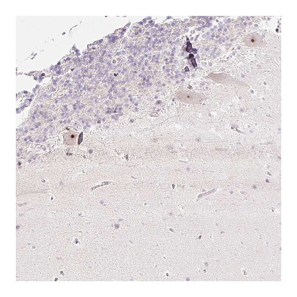 Atlas Antibodies Anti-ZNF417 Antibody