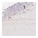 Atlas Antibodies Anti-ZNF417 Antibody