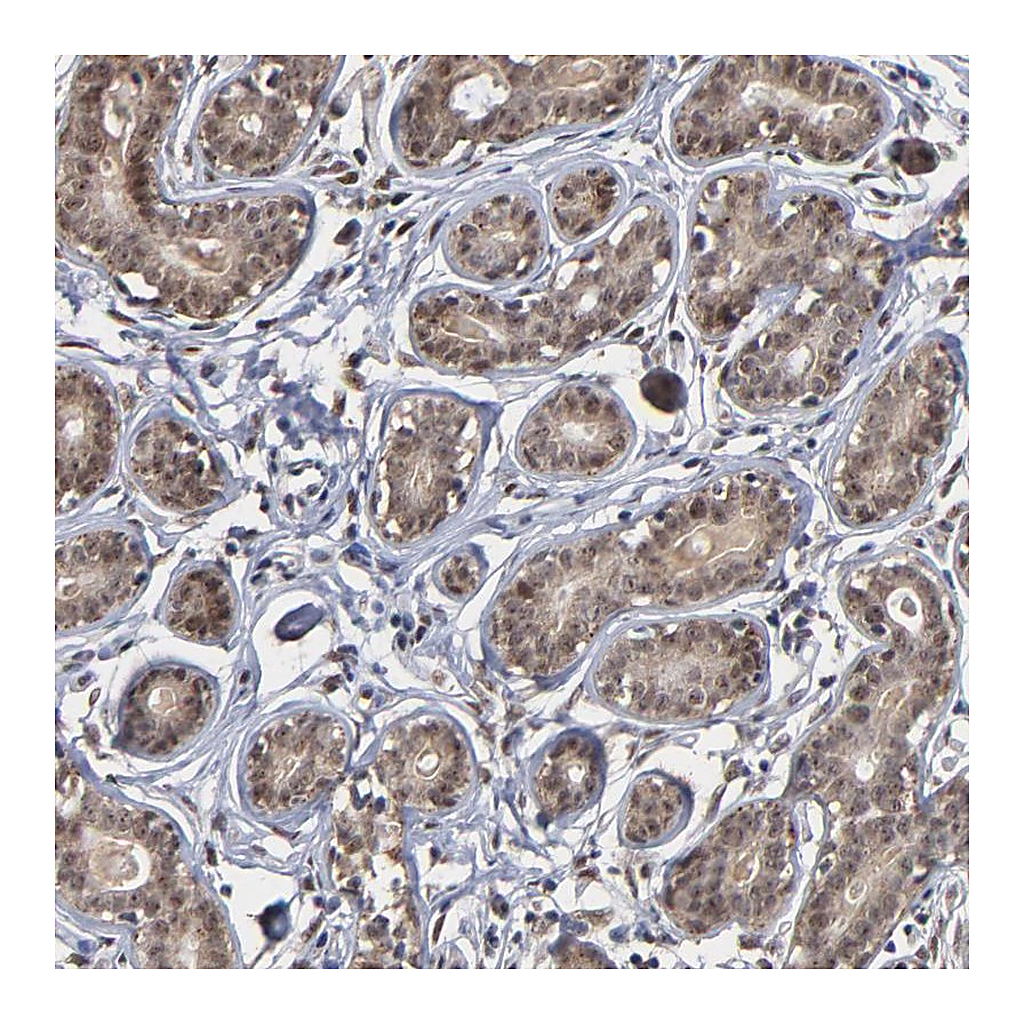 Atlas Antibodies Anti-ZNF419 Antibody