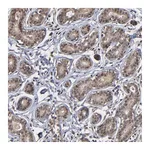 Atlas Antibodies Anti-ZNF419 Antibody
