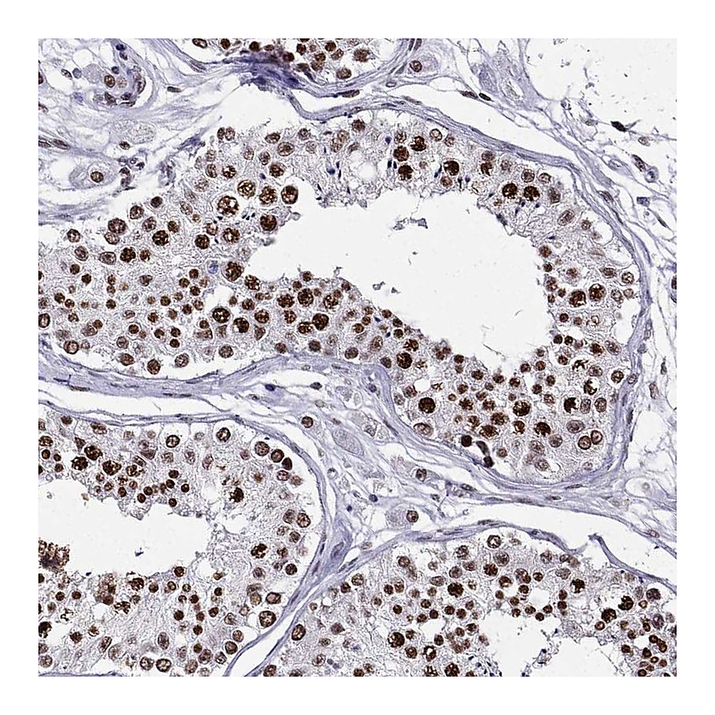 Atlas Antibodies Anti-ZNF420 Antibody