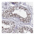 Atlas Antibodies Anti-ZNF420 Antibody