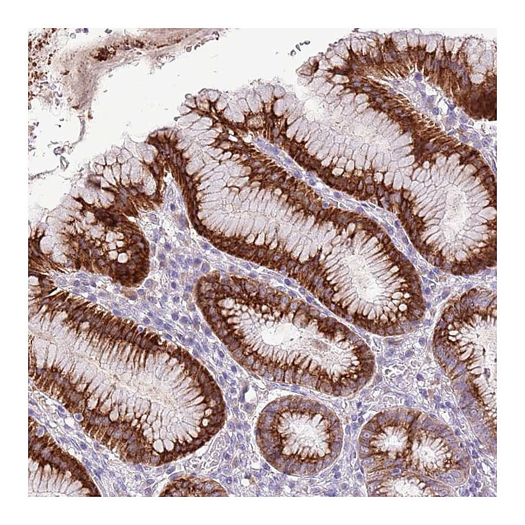 Atlas Antibodies Anti-ZNF425 Antibody
