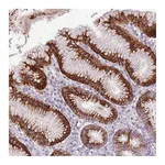 Atlas Antibodies Anti-ZNF425 Antibody