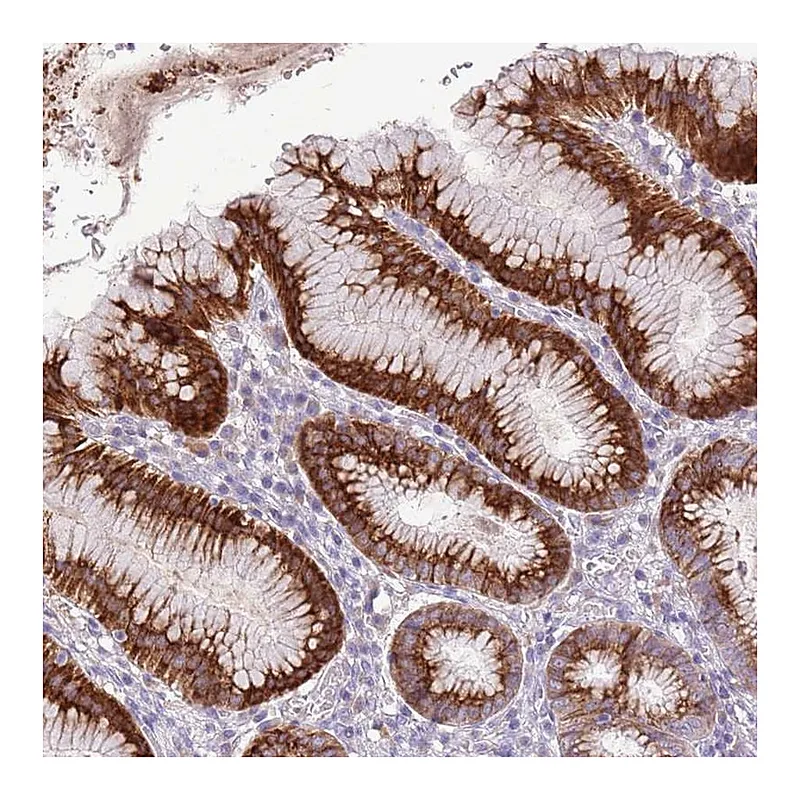 Atlas Antibodies Anti-ZNF425 Antibody