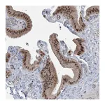 Atlas Antibodies Anti-ZNF426 Antibody