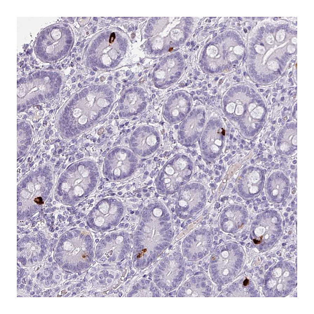 Atlas Antibodies Anti-ZNF43 Antibody