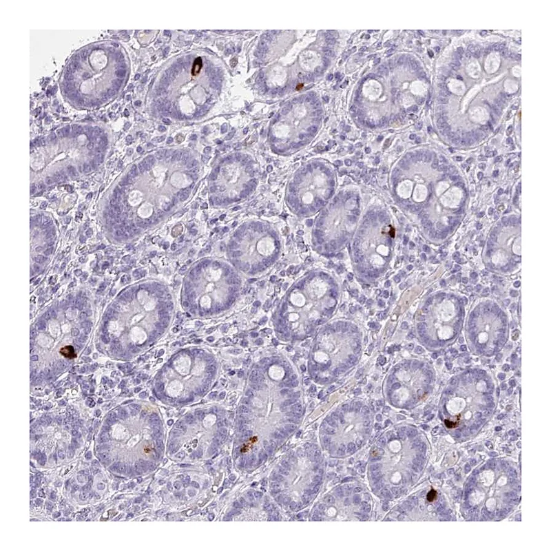 Atlas Antibodies Anti-ZNF43 Antibody