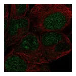 Atlas Antibodies Anti-ZNF429 Antibody