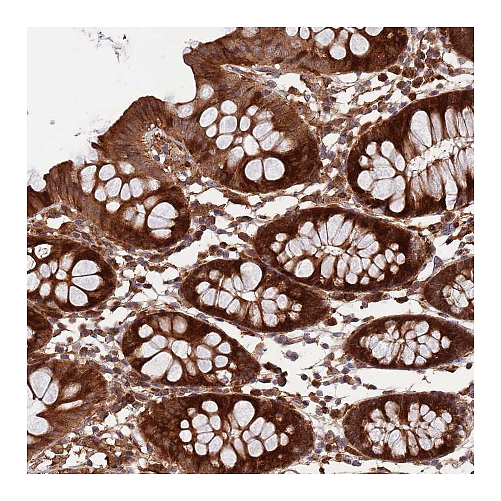 Atlas Antibodies Anti-ZNF428 Antibody