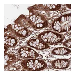 Atlas Antibodies Anti-ZNF428 Antibody