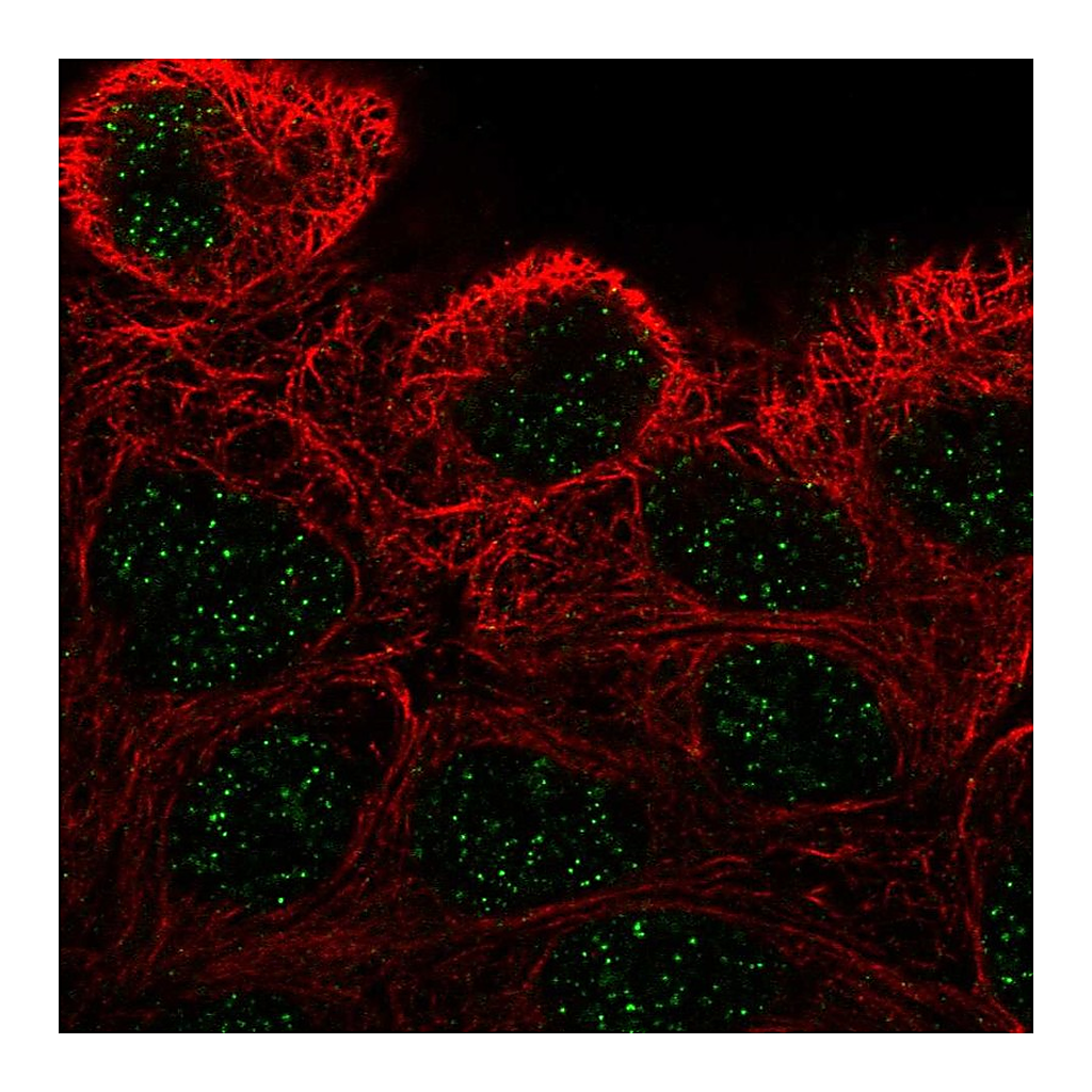 Atlas Antibodies Anti-ZNF432 Antibody