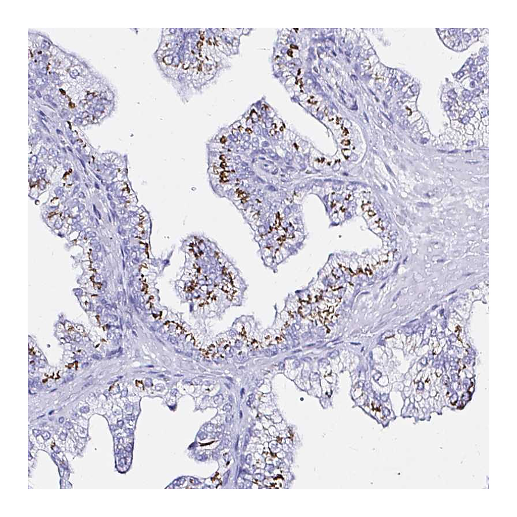 Atlas Antibodies Anti-ZNF432 Antibody