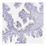 Atlas Antibodies Anti-ZNF432 Antibody