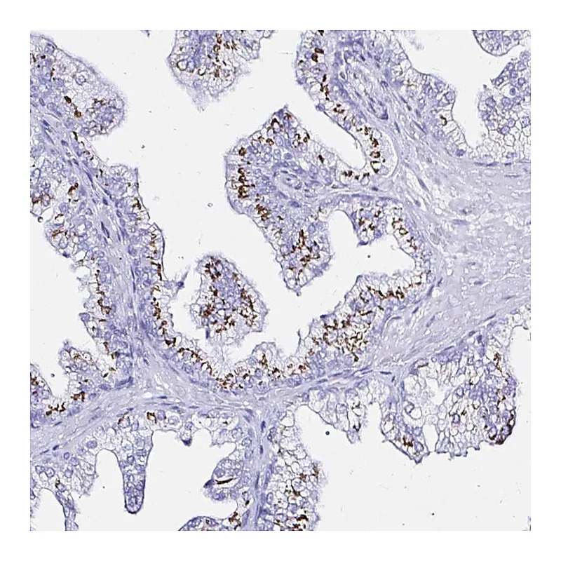Atlas Antibodies Anti-ZNF432 Antibody