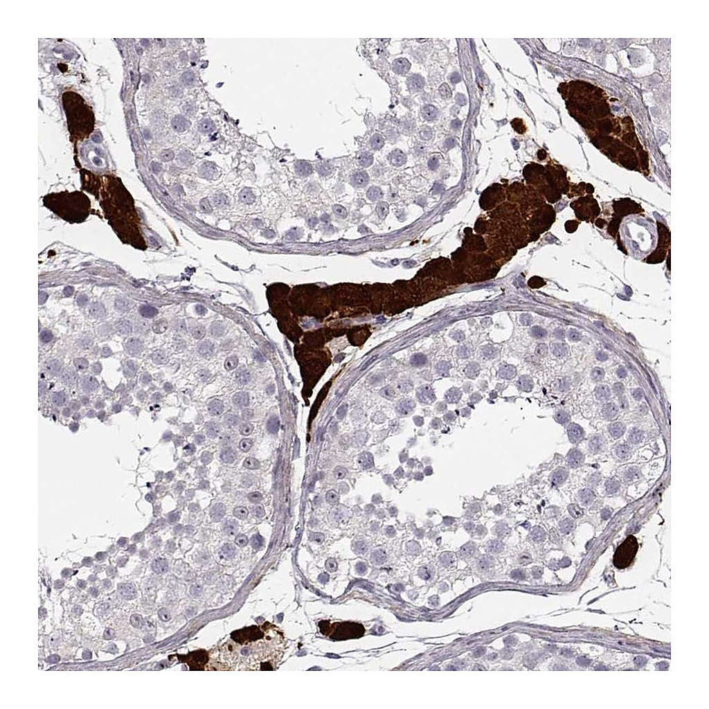 Atlas Antibodies Anti-ZNF433 Antibody