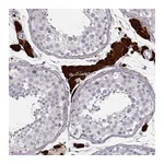 Atlas Antibodies Anti-ZNF433 Antibody