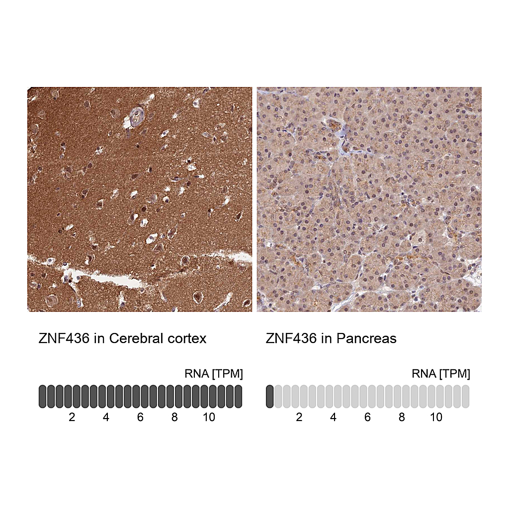Atlas Antibodies Anti-ZNF436 Antibody