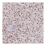 Atlas Antibodies Anti-ZNF439 Antibody
