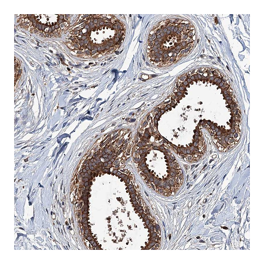 Atlas Antibodies Anti-ZNF438 Antibody