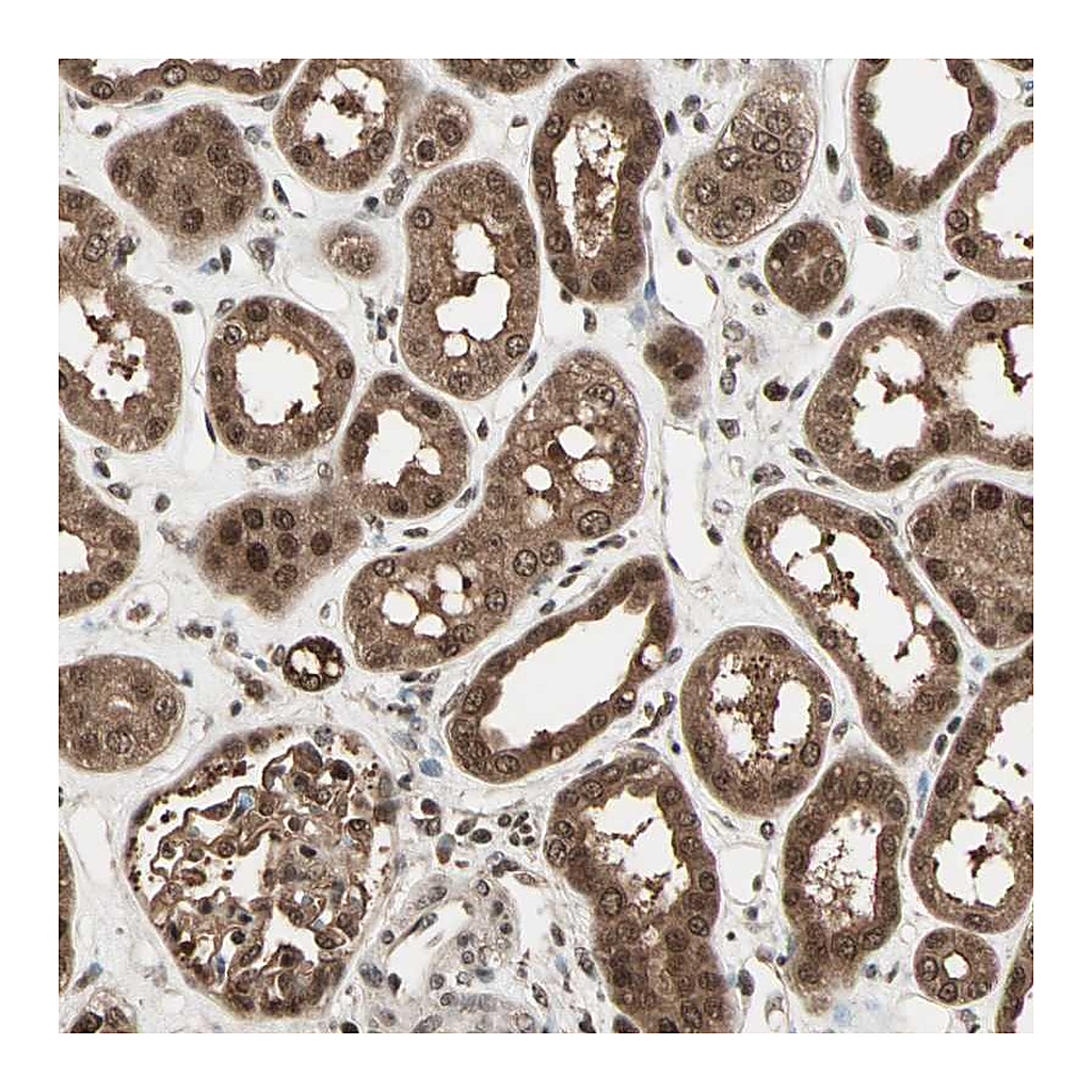 Atlas Antibodies Anti-ZNF44 Antibody