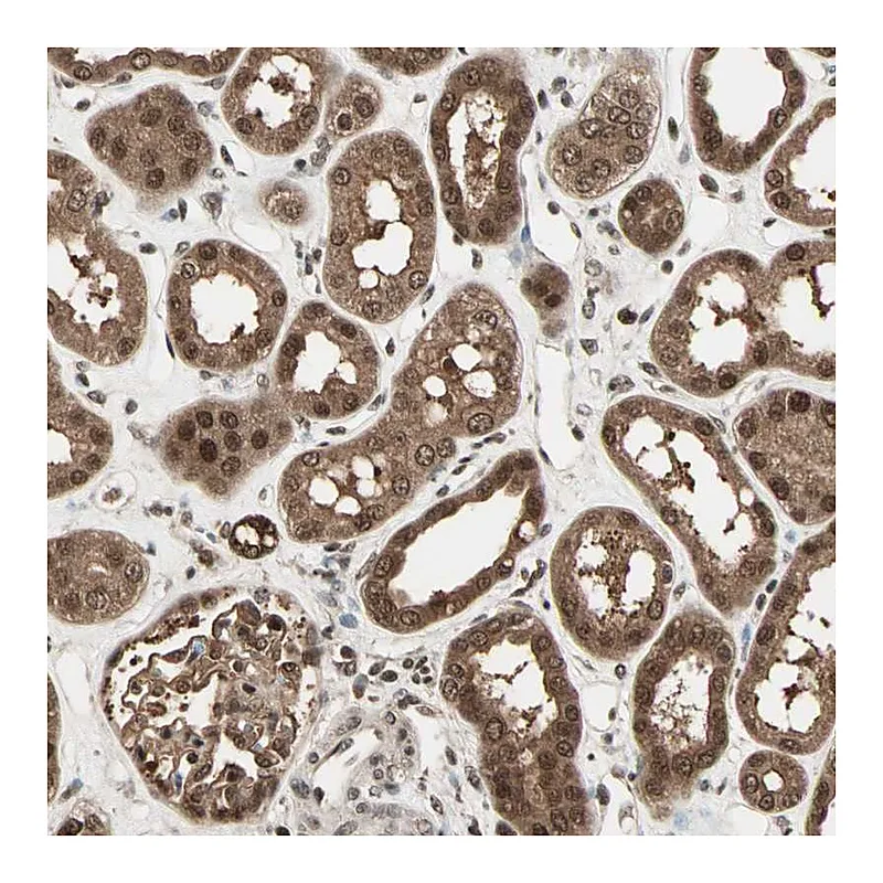 Atlas Antibodies Anti-ZNF44 Antibody