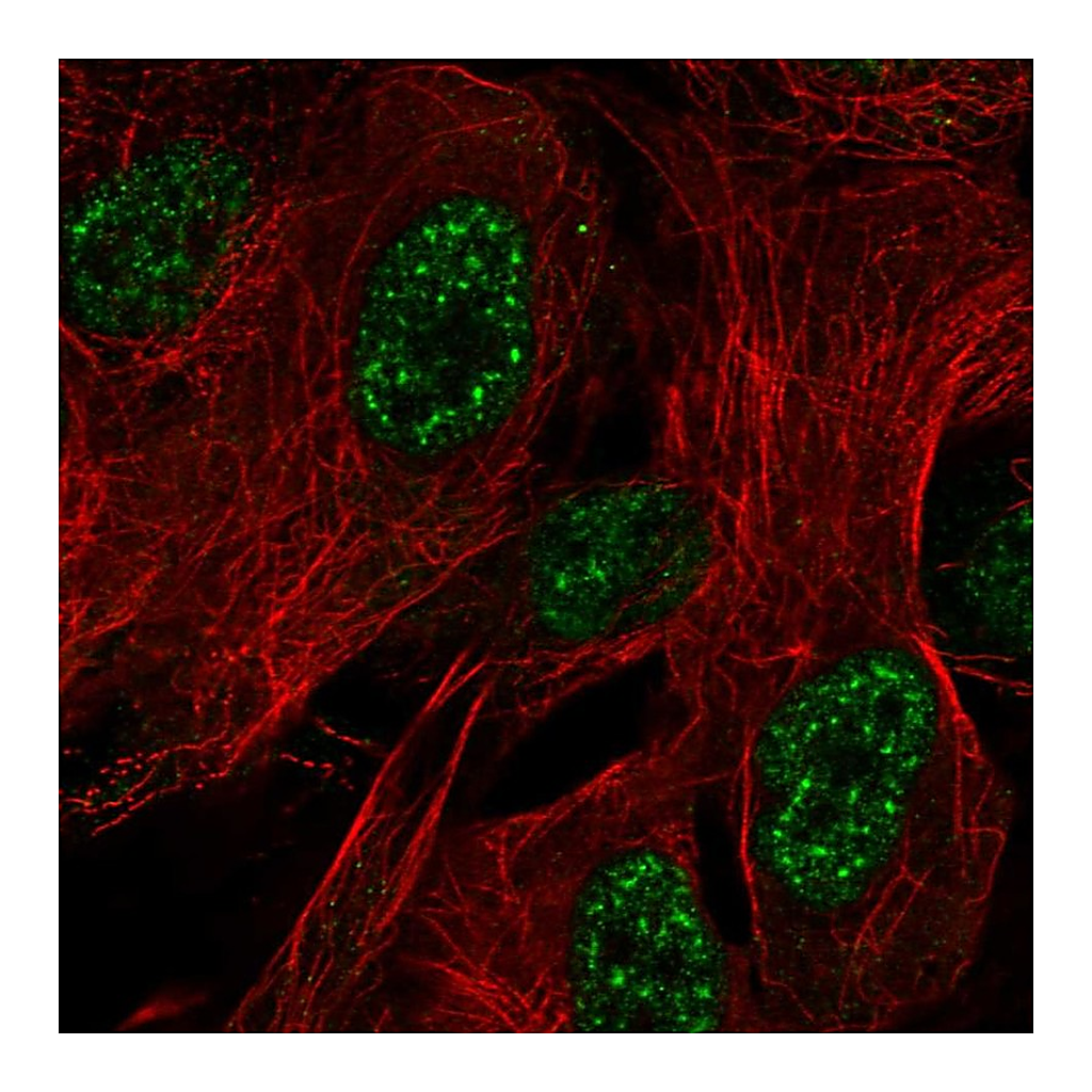 Atlas Antibodies Anti-ZNF441 Antibody