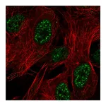 Atlas Antibodies Anti-ZNF441 Antibody