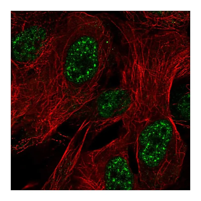 Atlas Antibodies Anti-ZNF441 Antibody