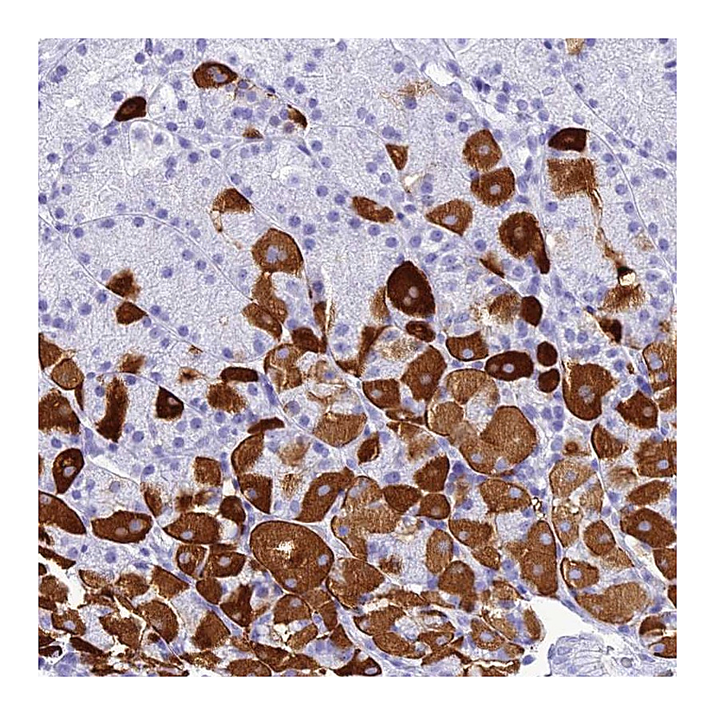 Atlas Antibodies Anti-ZNF442 Antibody