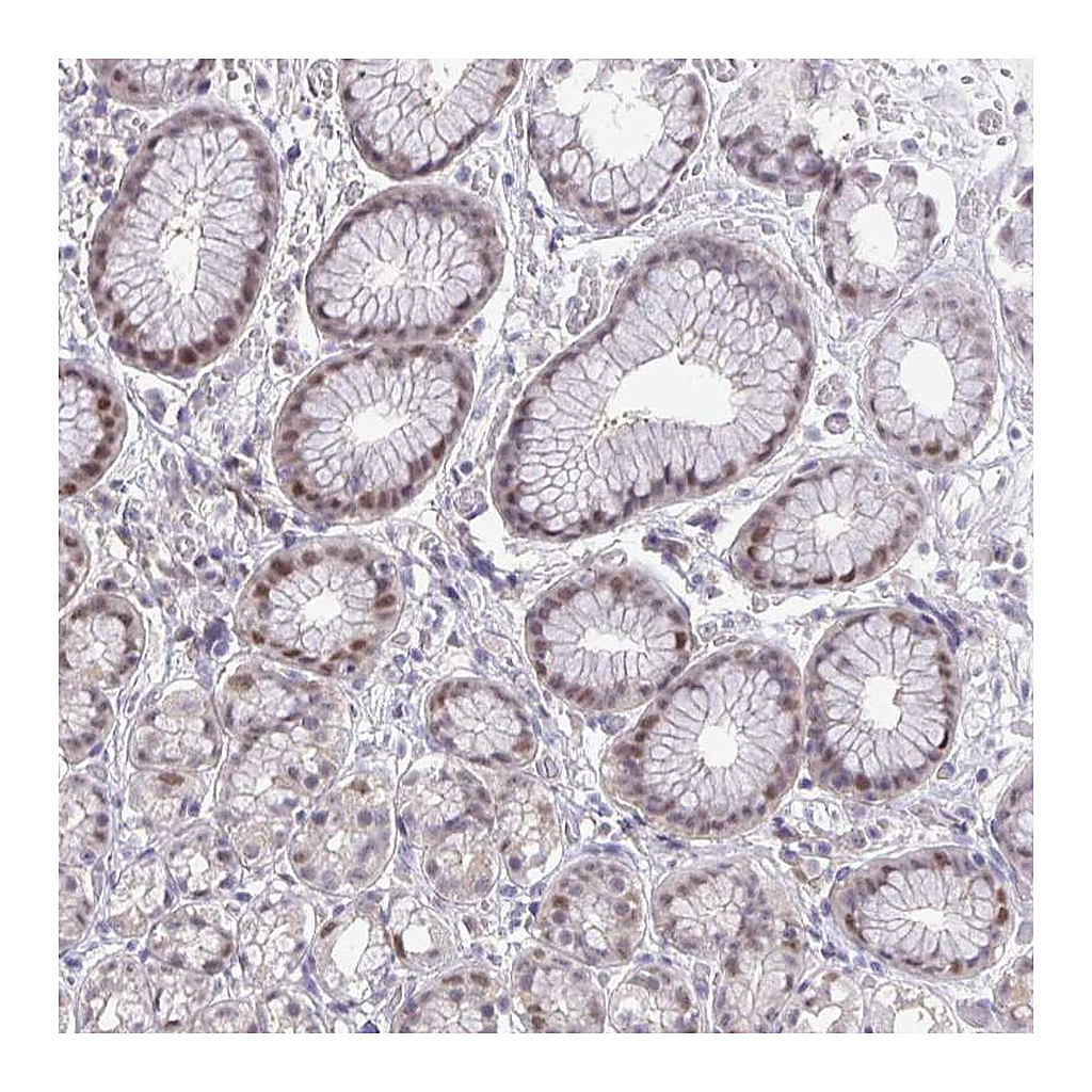 Atlas Antibodies Anti-ZNF444 Antibody