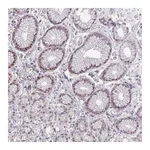 Atlas Antibodies Anti-ZNF444 Antibody