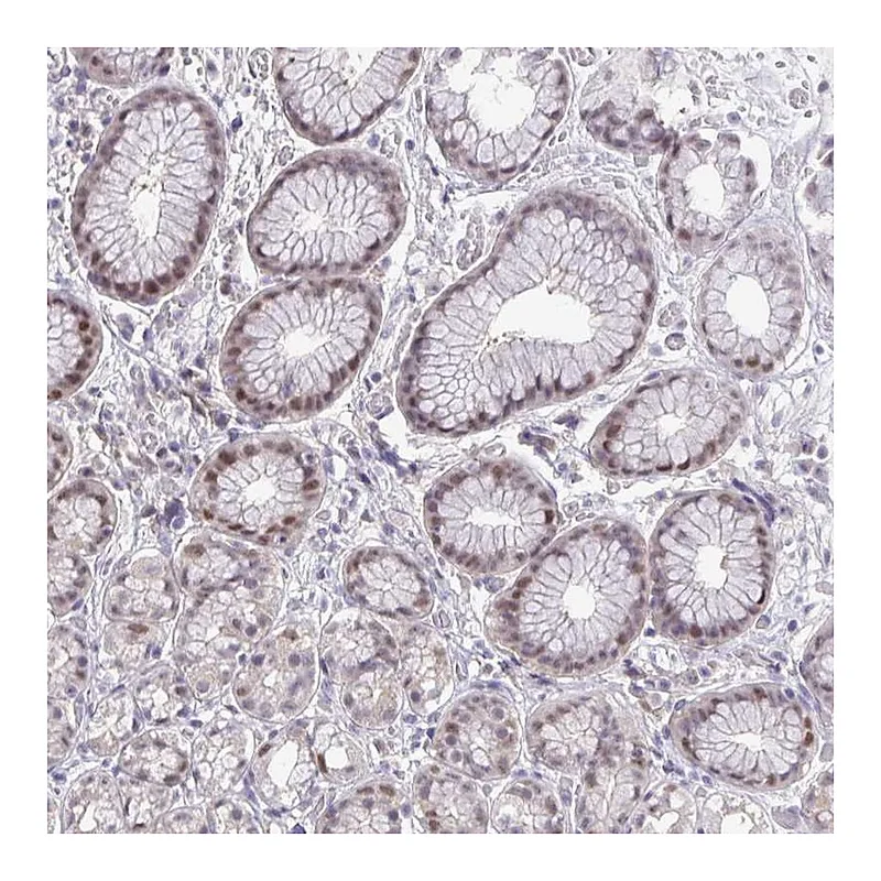 Atlas Antibodies Anti-ZNF444 Antibody