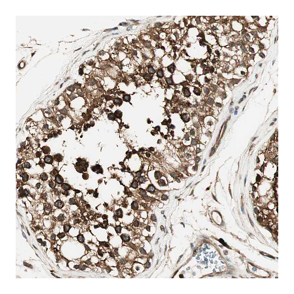Atlas Antibodies Anti-ZNF443 Antibody