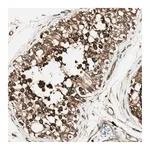 Atlas Antibodies Anti-ZNF443 Antibody