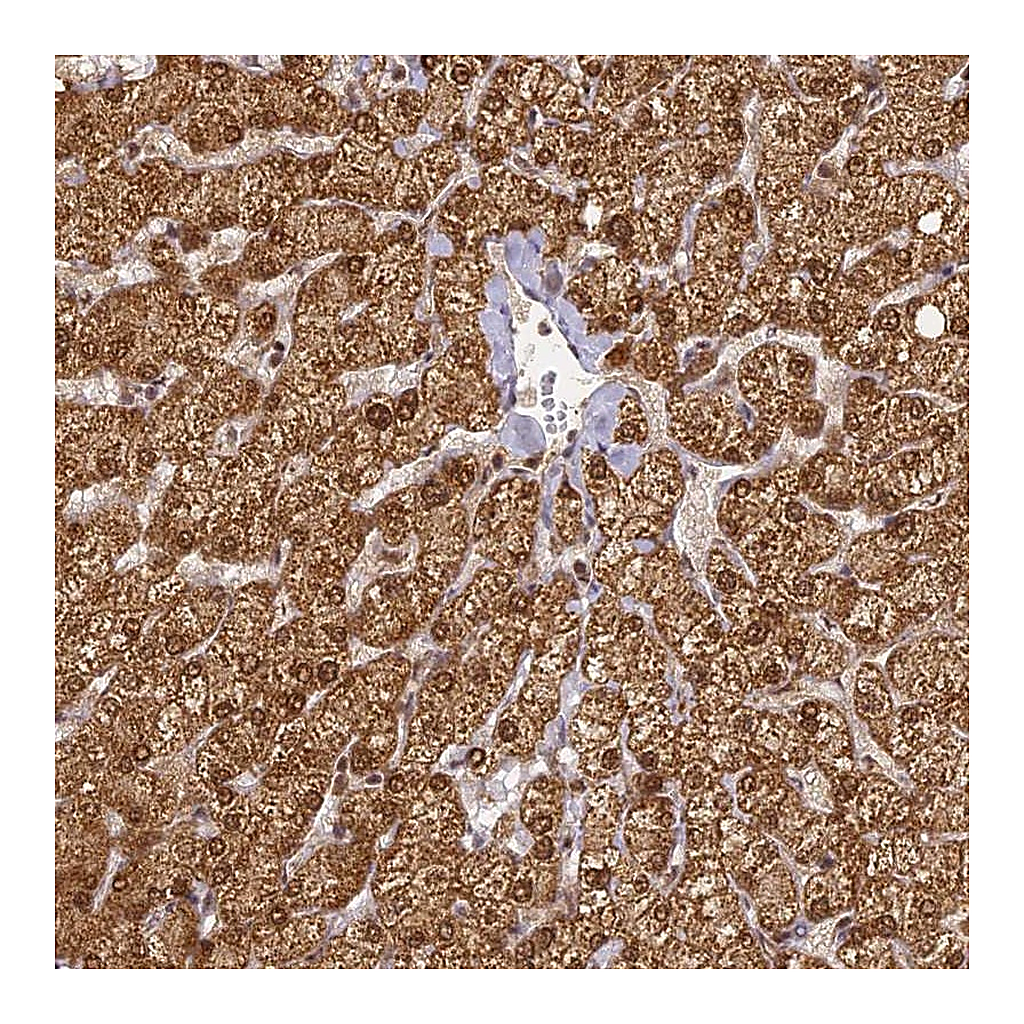 Atlas Antibodies Anti-ZNF443 Antibody