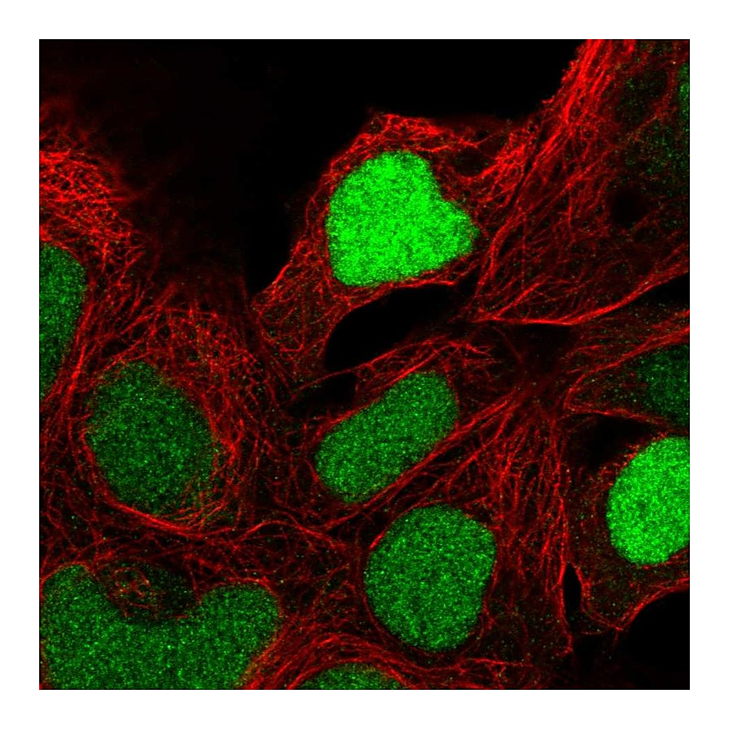 Atlas Antibodies Anti-ZNF444 Antibody