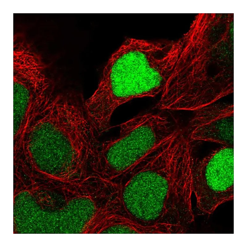 Atlas Antibodies Anti-ZNF444 Antibody