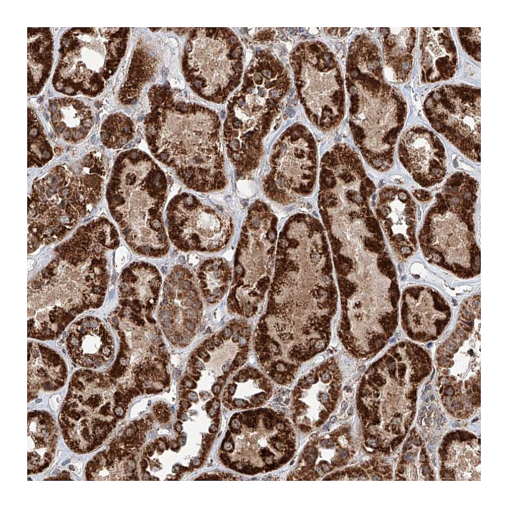 Atlas Antibodies Anti-ZNF445 Antibody