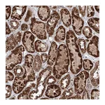 Atlas Antibodies Anti-ZNF445 Antibody