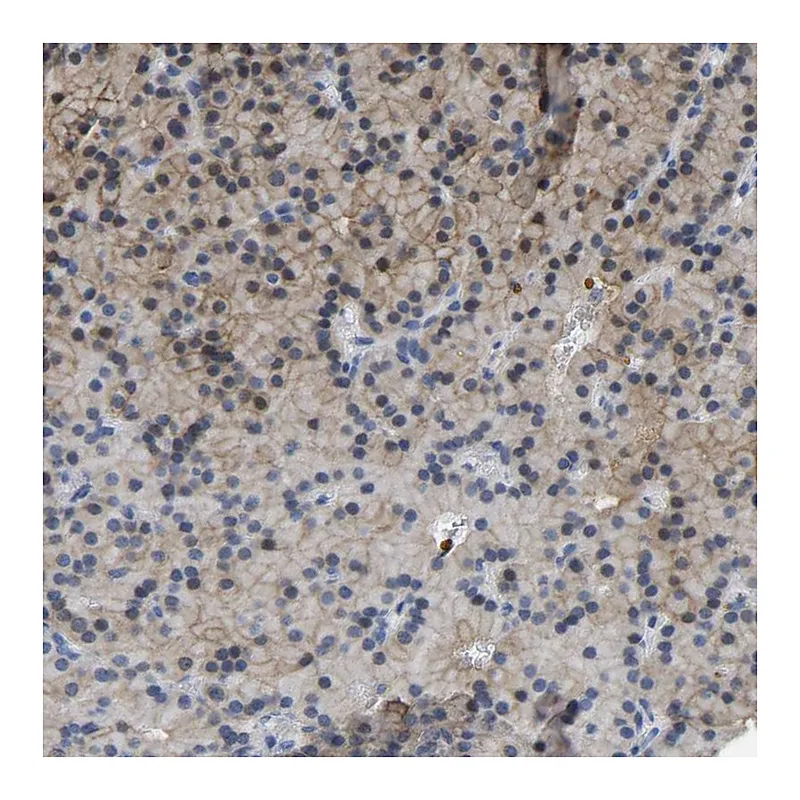 Atlas Antibodies Anti-ZNF449 Antibody