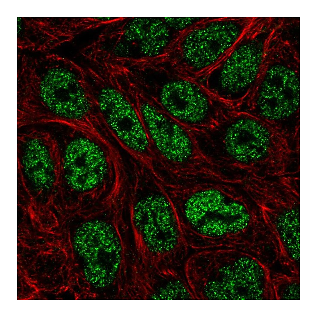 Atlas Antibodies Anti-ZNF45 Antibody