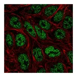 Atlas Antibodies Anti-ZNF45 Antibody